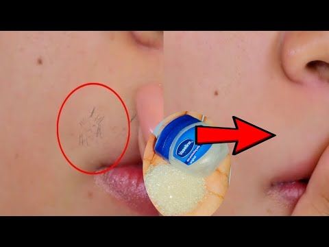 This Vaseline Trick Can Help You Remove Unwanted Hair